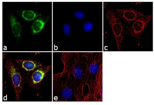 CA125 Antibody in Immunocytochemistry (ICC/IF)
