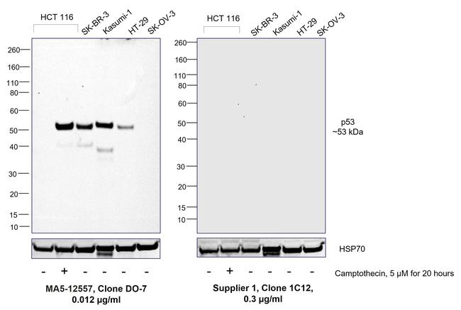 p53 Antibody in Western Blot (WB)