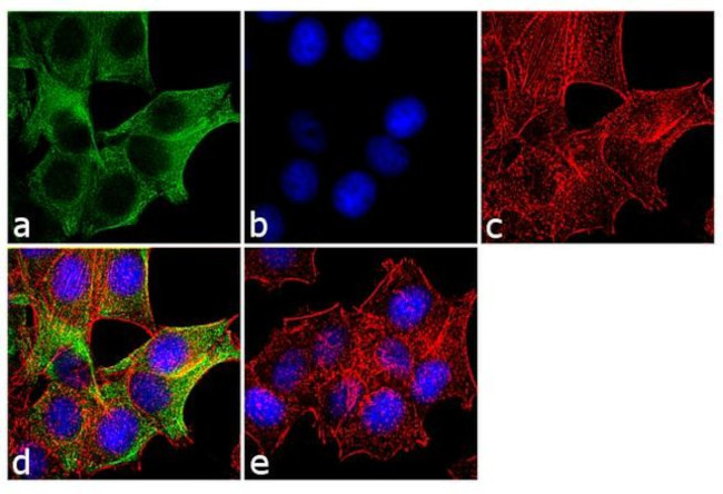 Cytokeratin 19 Antibody in Immunocytochemistry (ICC/IF)
