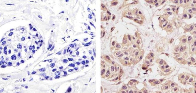 Cyclin D1 Antibody in Immunohistochemistry (Paraffin) (IHC (P))
