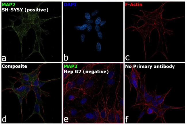 MAP2 Antibody in Immunocytochemistry (ICC/IF)