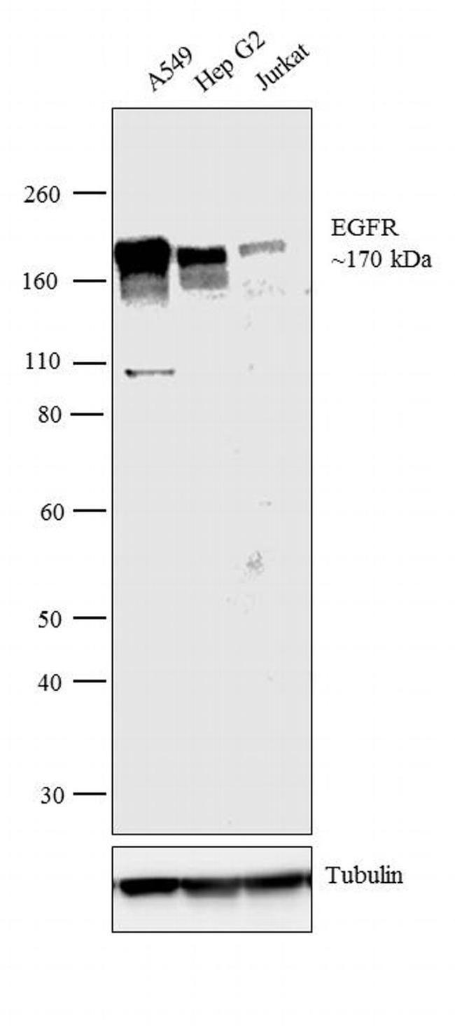 EGFR Antibody in Western Blot (WB)