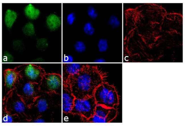 Filaggrin Antibody in Immunocytochemistry (ICC/IF)