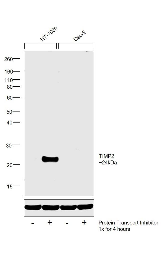 TIMP2 Antibody in Western Blot (WB)