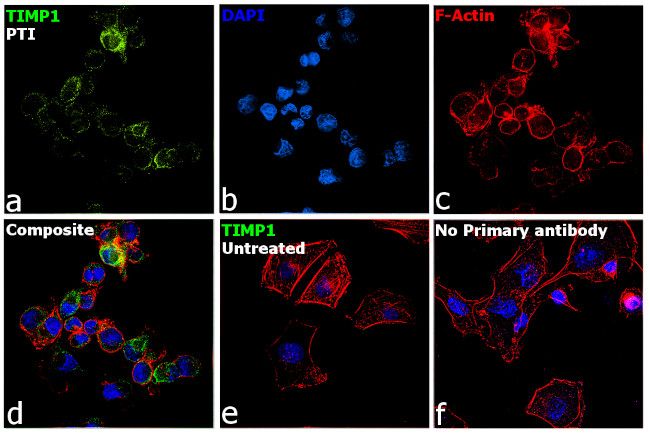 TIMP1 Antibody in Immunocytochemistry (ICC/IF)