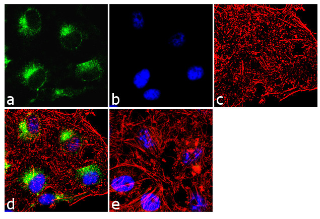CDK4 Antibody in Immunocytochemistry (ICC/IF)