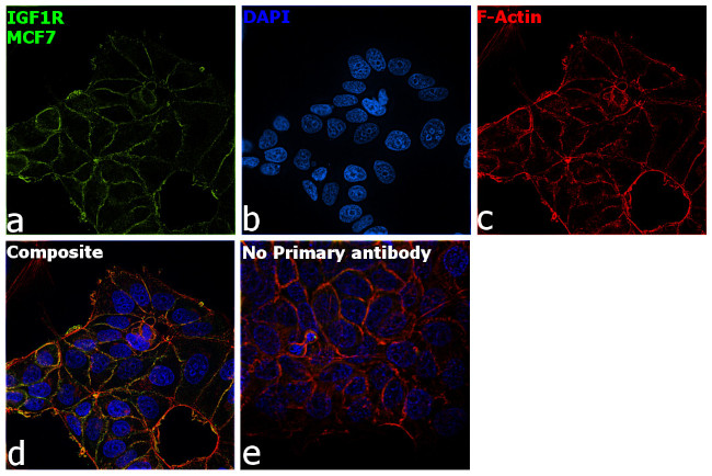 IGF1R beta Antibody in Immunocytochemistry (ICC/IF)