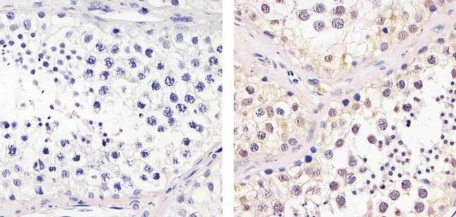 Cdc25C Antibody in Immunohistochemistry (Paraffin) (IHC (P))