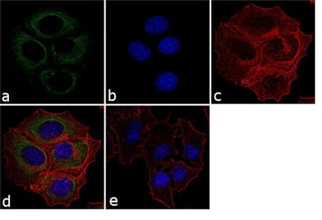 p73 Antibody in Immunocytochemistry (ICC/IF)