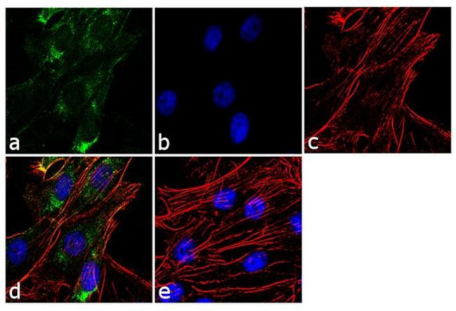 MMP3 Antibody in Immunocytochemistry (ICC/IF)