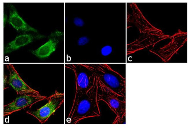 MMP13 Antibody in Immunocytochemistry (ICC/IF)