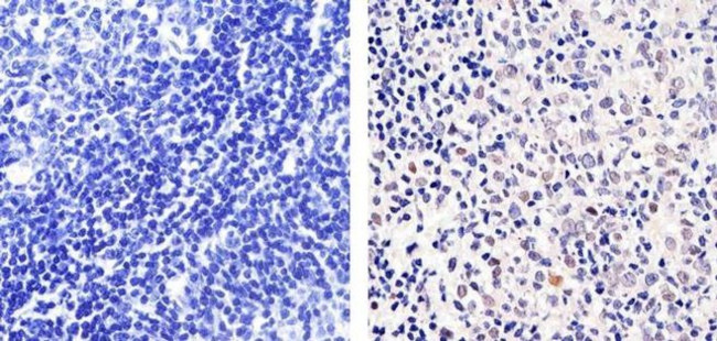 E2F1 Antibody in Immunohistochemistry (Paraffin) (IHC (P))