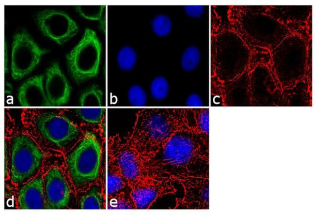 Cytokeratin 8 Antibody in Immunocytochemistry (ICC/IF)