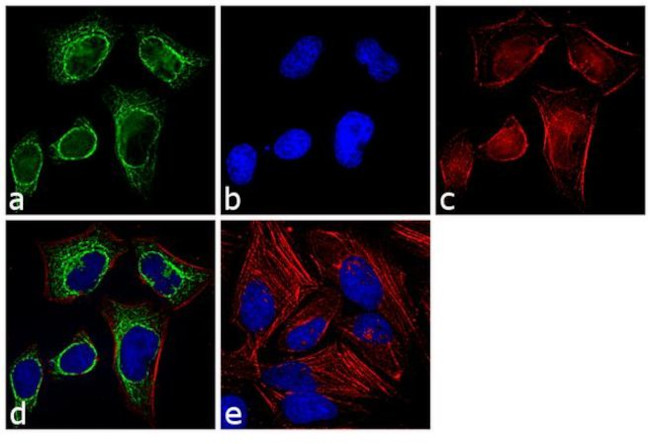Cytokeratin 8 Antibody in Immunocytochemistry (ICC/IF)