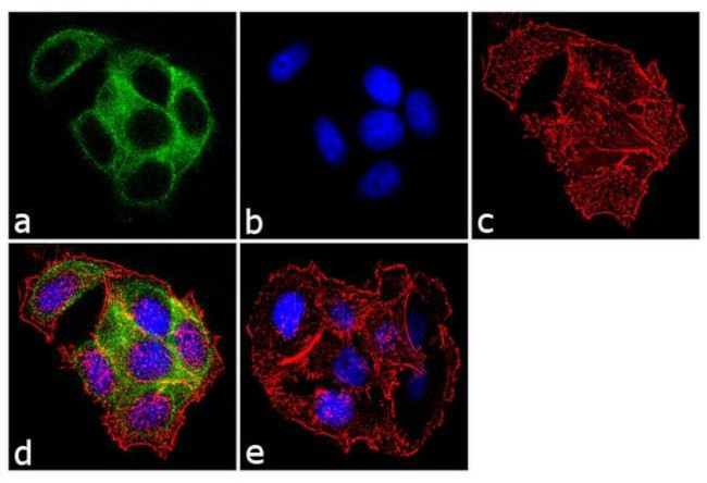 Cytokeratin 18 Antibody in Immunocytochemistry (ICC/IF)