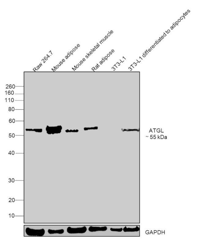 ATGL Monoclonal Antibody K 751 7 MA5 14990 atgl-monoclonal-antibody-k-751-7-ma5-14990