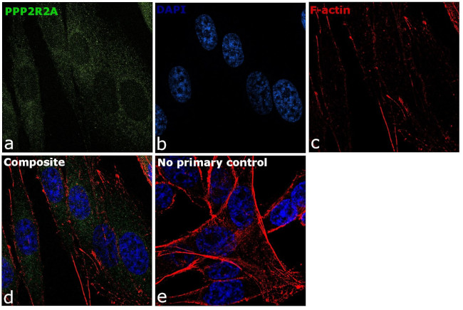 PPP2R2A Antibody in Immunocytochemistry (ICC/IF)