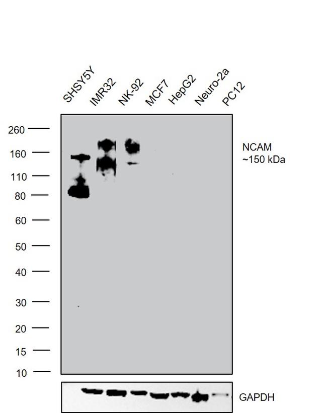 CD56 Antibody in Western Blot (WB)