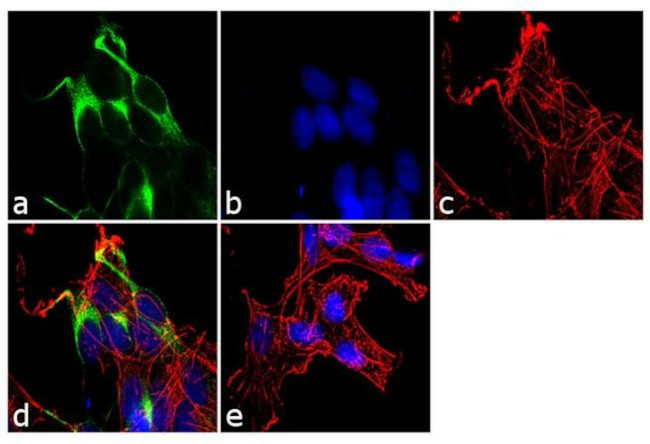 Neurofilaments 70/200 kDa Antibody in Immunocytochemistry (ICC/IF)