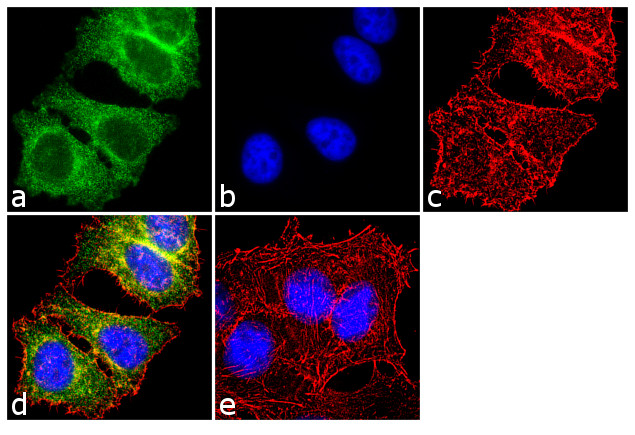 p53 Antibody in Immunocytochemistry (ICC/IF)