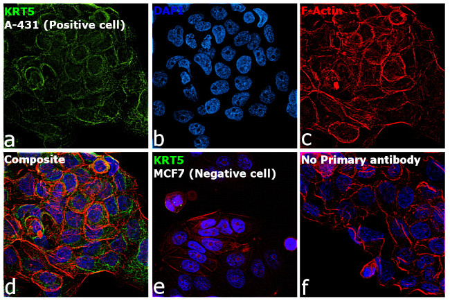 Cytokeratin 5 Antibody in Immunocytochemistry (ICC/IF)
