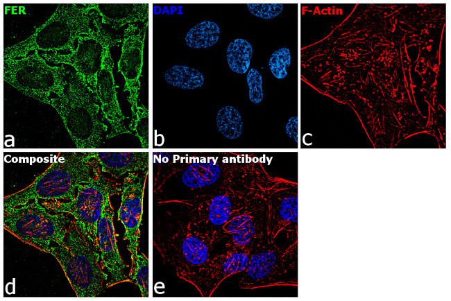 FER Antibody in Immunocytochemistry (ICC/IF)