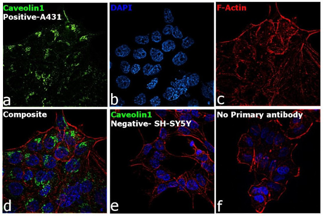 Caveolin 1 Antibody in Immunocytochemistry (ICC/IF)