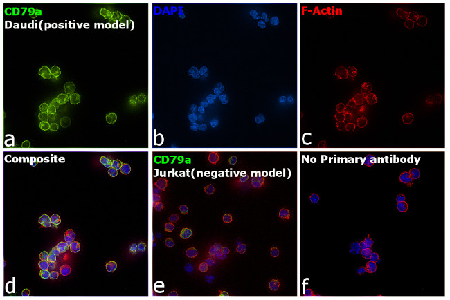 CD79a Antibody in Immunocytochemistry (ICC/IF)