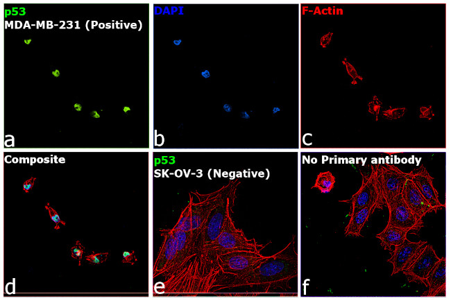 p53 Antibody in Immunocytochemistry (ICC/IF)