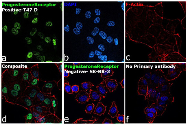 Progesterone Receptor Antibody in Immunocytochemistry (ICC/IF)
