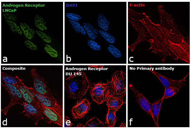 Androgen Receptor Antibody in Immunocytochemistry (ICC/IF)