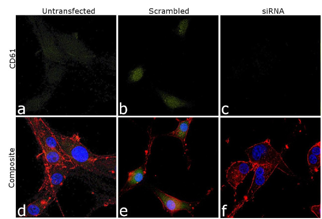 CD61 Antibody in Immunocytochemistry (ICC/IF)