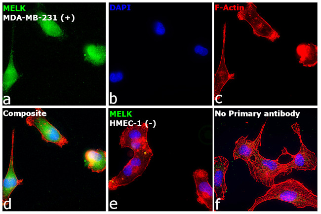 MELK Antibody in Immunocytochemistry (ICC/IF)