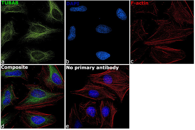 TUBA8 Antibody in Immunocytochemistry (ICC/IF)