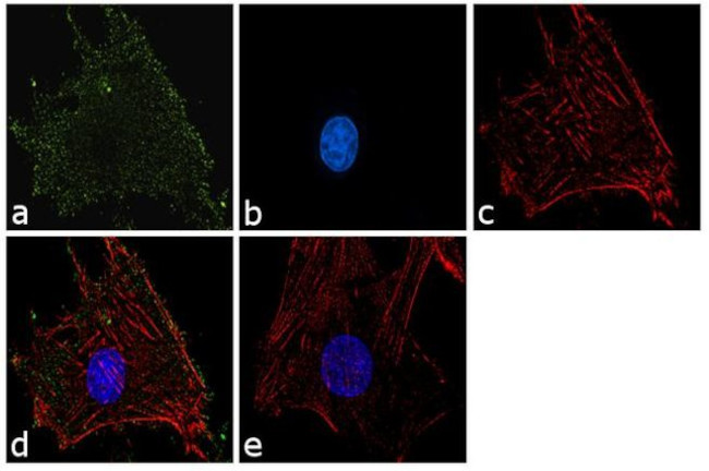 RIP2 Antibody in Immunocytochemistry (ICC/IF)