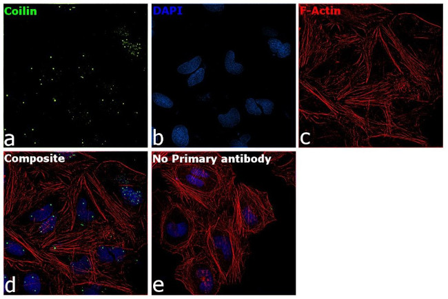 Coilin Antibody in Immunocytochemistry (ICC/IF)