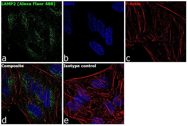 LAMP2 Antibody in Immunocytochemistry (ICC/IF)