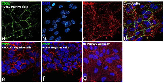 CD31 Antibody in Immunocytochemistry (ICC/IF)