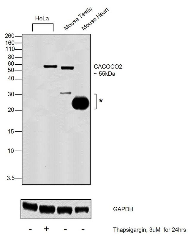 CALCOCO2 Antibody