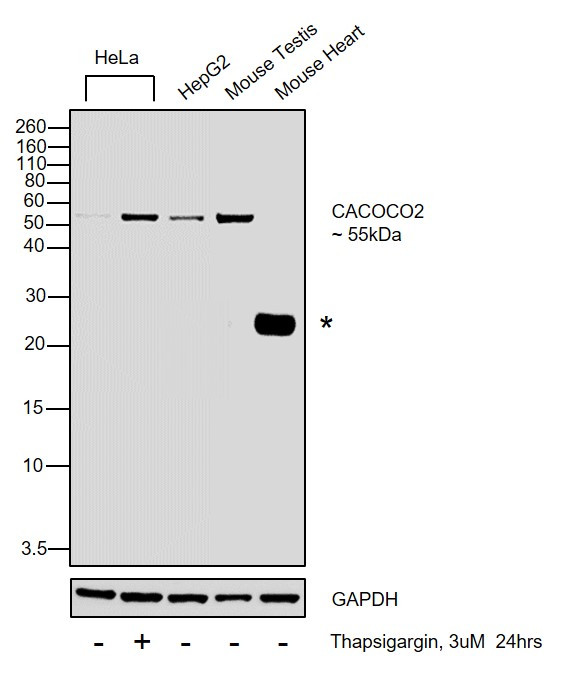 CALCOCO2 Antibody