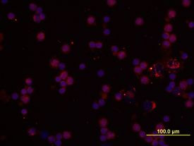 IL-1 alpha Antibody in Immunocytochemistry (ICC/IF)