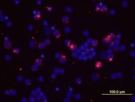IL-2 Antibody in Immunocytochemistry (ICC/IF)