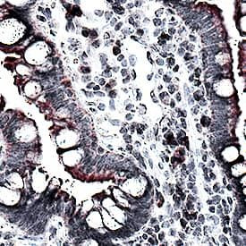 MCP-1 Antibody in Immunohistochemistry (Paraffin) (IHC (P))