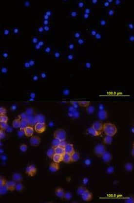 CD25 Antibody in Immunocytochemistry (ICC/IF)