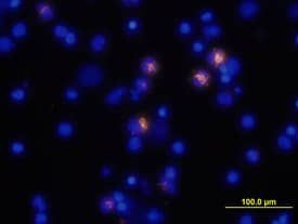 TNF alpha Antibody in Immunocytochemistry (ICC/IF)