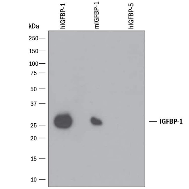 IGFBP-1 Antibody in Western Blot (WB)