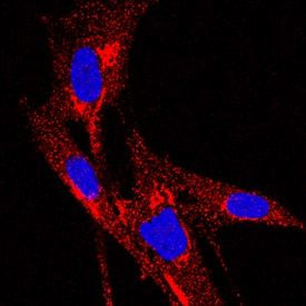 TIMP1 Antibody in Immunocytochemistry (ICC/IF)