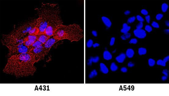 ICAM-1 Antibody in Immunocytochemistry (ICC/IF)