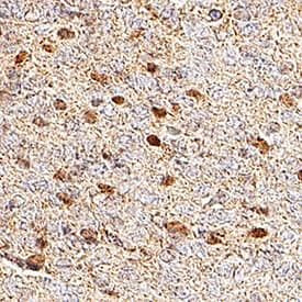 OLIG1/OLIG2/OLIG3 Antibody in Immunohistochemistry (Paraffin) (IHC (P))