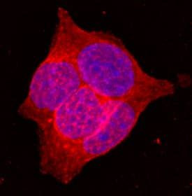 GLUT2 Antibody in Immunocytochemistry (ICC/IF)